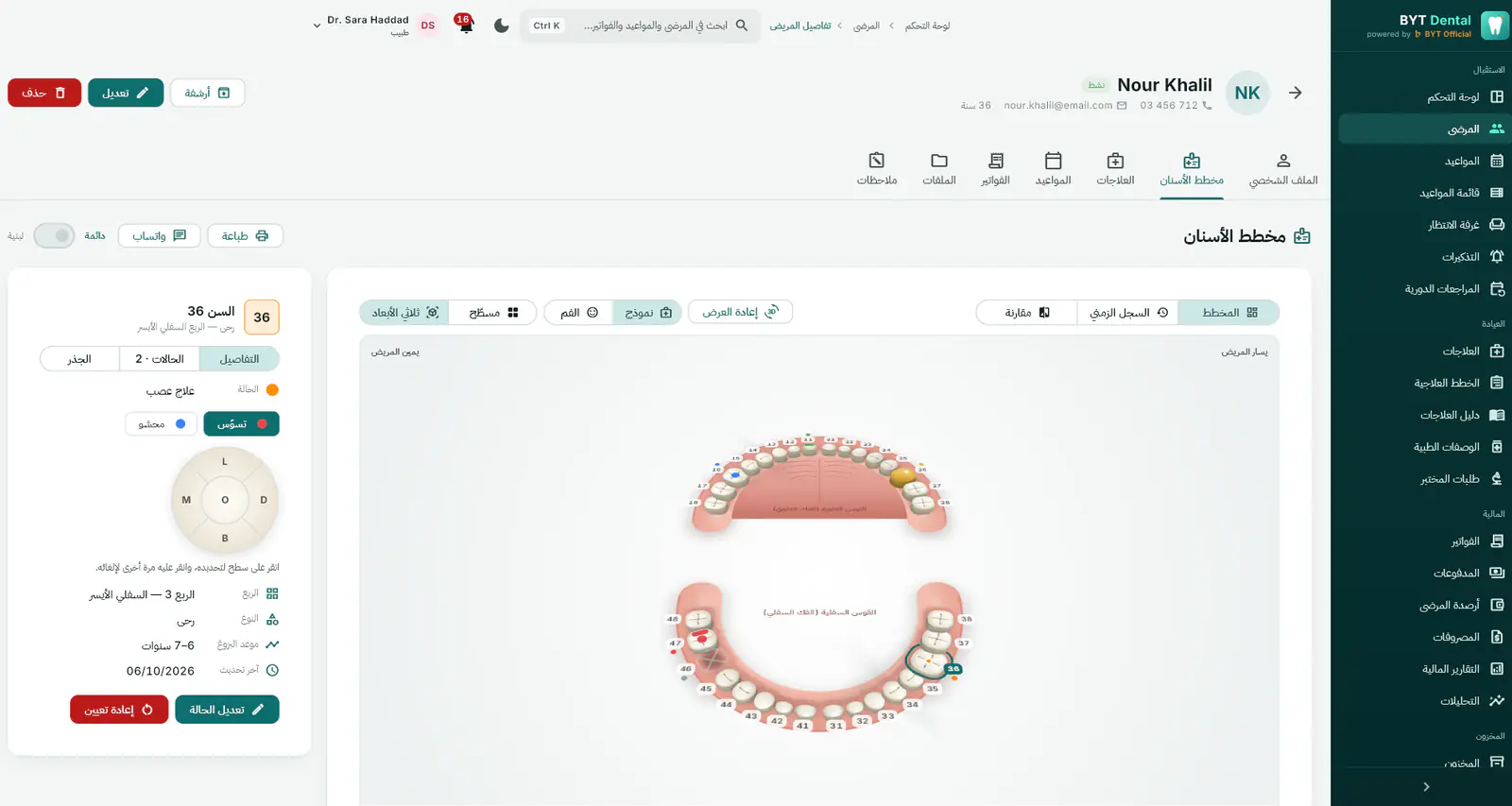 مخطط الأسنان ثلاثي الأبعاد في BYT Dental يعرض أسنان المريض